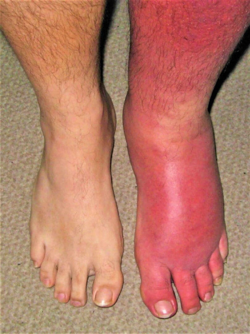 A person with red skin and feet on the ground.